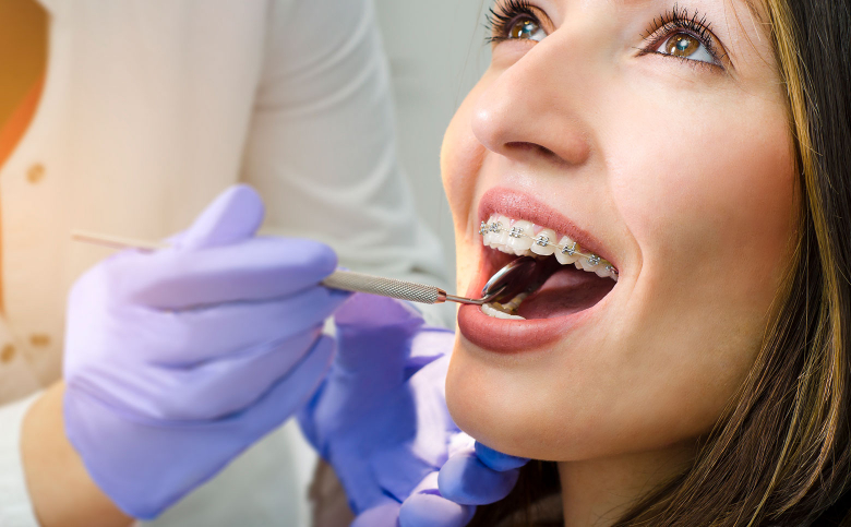 Storitve ortodontija