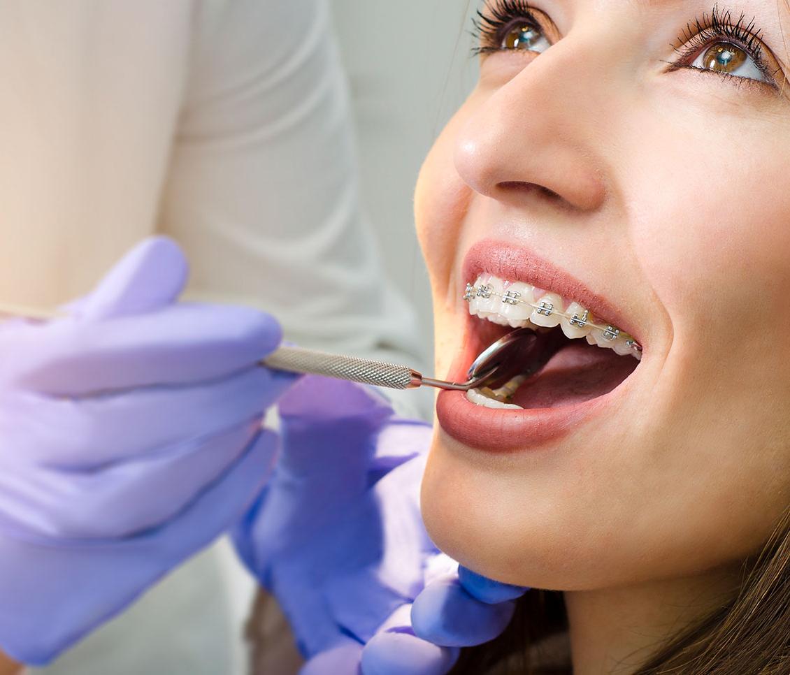 Storitve ortodontija